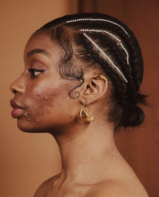 5 Skincare Mistakes You Don’t Even Know You’re Making